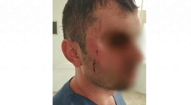 Sağlık çalışanına şiddet: 1 yaralı