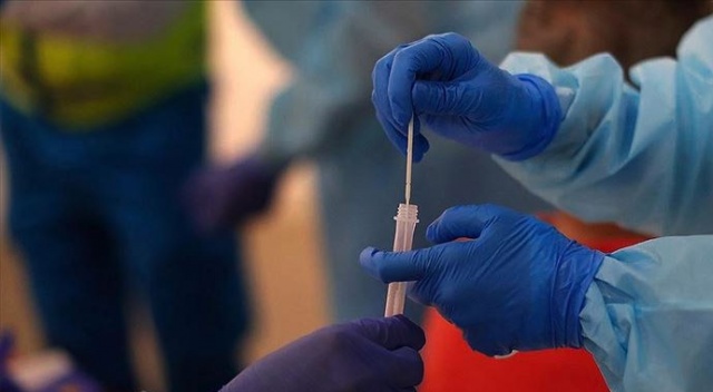 Dünya genelinde Kovid-19'dan iyileşenlerin sayısı 34 milyonu geçti Dünya genelinde Kovid-19'dan iyileşenlerin sayısı 34 milyonu geçti