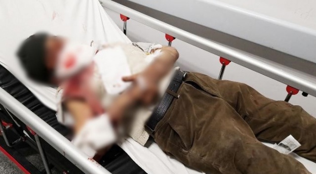 Köpek yaşlı adamın önce yüzünü, sonra vücudunu parçaladı Köpek yaşlı adamın önce yüzünü, sonra vücudunu parçaladı