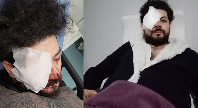 Şişli’de silahlı kavgada gözünü kaybeden genç şarkıcı dehşet anlarını anlattı