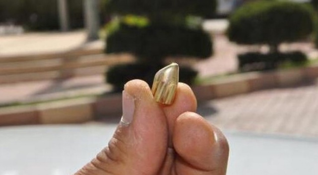 Omzuna "yorgun mermi" isabet eden çiftçi yaralandı