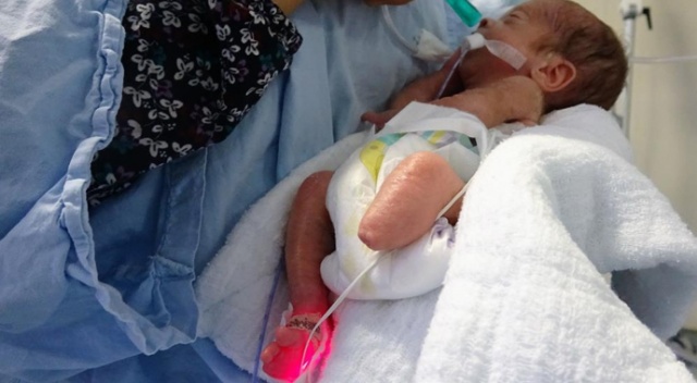 Parmak bebek ayaksız olarak dünyaya geldi