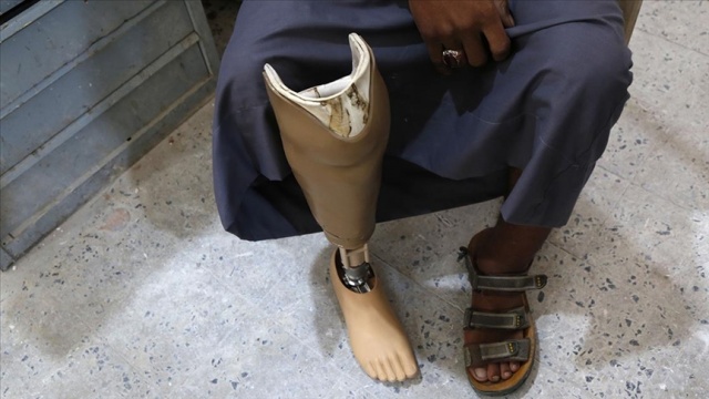 Yemen'de 2020'de 1363 sivil öldürüldü ya da yaralandı Yemen'de 2020'de 1363 sivil öldürüldü ya da yaralandı