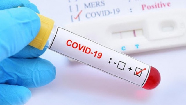 İsrail: Pfizer-BionTech aşısı Kovid-19 salgınında ölümleri yüzde 98,9 önlüyor İsrail: Pfizer-BionTech aşısı Kovid-19 salgınında ölümleri yüzde 98,9 önlüyor