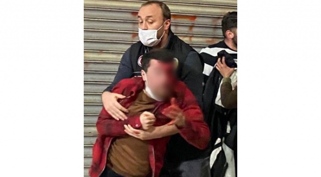 Polisin darp ettiği iddia edilen vatandaş kendisini eylemcilerin yaraladığını söyledi Polisin darp ettiği iddia edilen vatandaş kendisini eylemcilerin yaraladığını söyledi