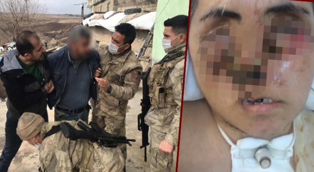 Eniştesinin saldırısı sonucu ağır yaralandı, yüzü tanınmayacak hale geldi