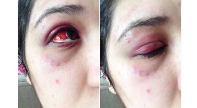 Genç kızı darp eden avukat: Alkolü döktüm diye şişe fırlatıp tokat attı Genç kızı darp eden avukat: Alkolü döktüm diye şişe fırlatıp tokat attı