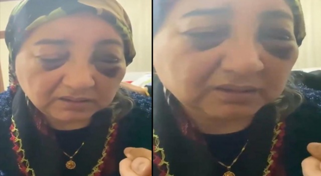 Bu nasıl vahşet? Dövüldü, odaya kilitlendi iki gün aç ve susuz bırakıldı