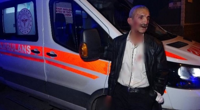 Engelli kardeşini bıçaklayıp başında sigara içti Engelli kardeşini bıçaklayıp başında sigara içti