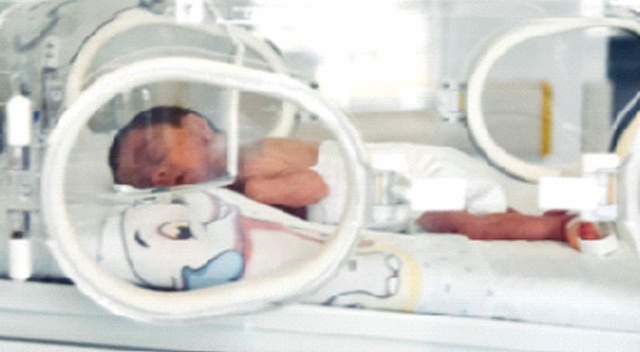 26 haftalık bebek hayata bağlandı