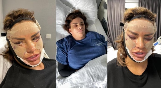 Şarkıcı Katie Price Türkiye&#039;de bıçak altına yattı