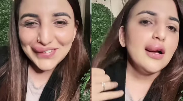 Banka hesabı donduruldu, estetik ameliyatı yarım kaldı Banka hesabı donduruldu, estetik ameliyatı yarım kaldı