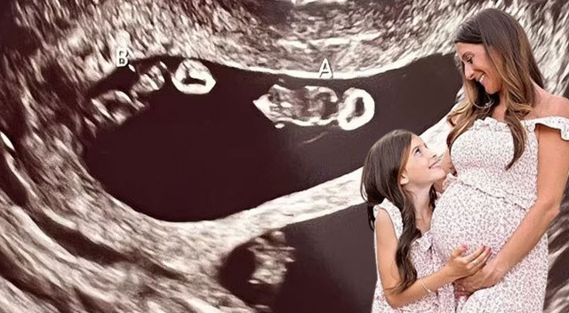 70 milyonda bir ihtimal: Anne adayı aynı anda iki ikiz bebek bekliyor 70 milyonda bir ihtimal: Anne adayı aynı anda iki ikiz bebek bekliyor
