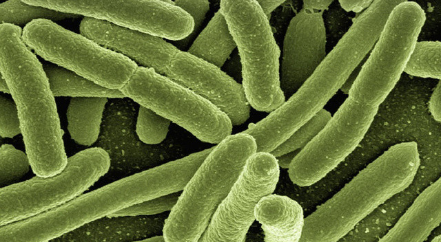 Yeniden salmonella alarmı! Bir markada daha tespit edildi... Türkiye'de de fabrikası bulunuyor Yeniden salmonella alarmı! Bir markada daha tespit edildi... Türkiye'de de fabrikası bulunuyor