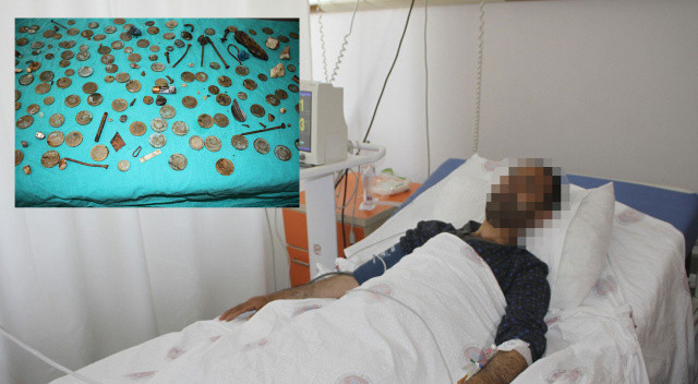 Madeni para, pil, mıktanıs, çivi ve dahası... Midesinden tam 233 cisim çıktı Madeni para, pil, mıktanıs, çivi ve dahası... Midesinden tam 233 cisim çıktı