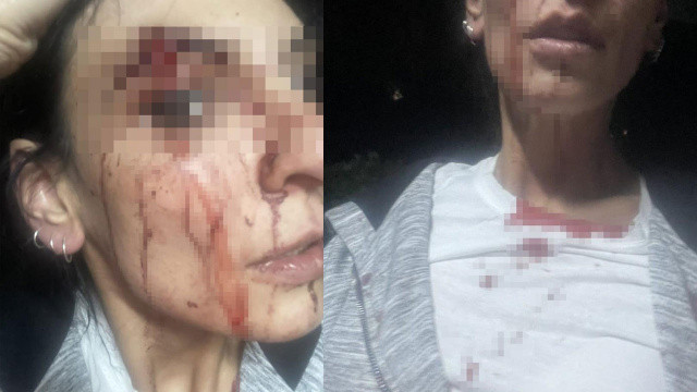 Sitede alkol alınmasına kızdılar, iki kadını tekme tokat dövdüler