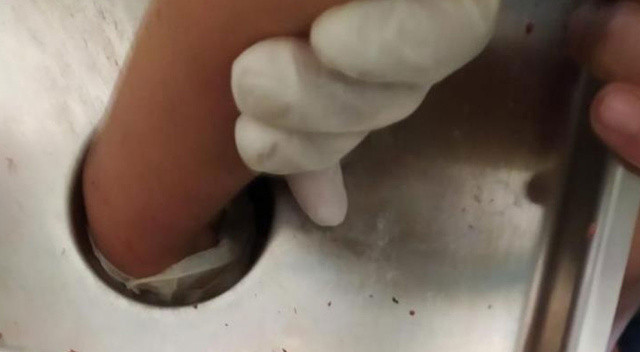 Aileler dikkat! 4 yaşındaki çocuk elini kıyma makinesine kaptırdı Aileler dikkat! 4 yaşındaki çocuk elini kıyma makinesine kaptırdı