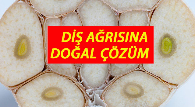 Çare evinizde: Diş ağrısını bıçak gibi kesiyor! Bir kenara mutlaka not edin Çare evinizde: Diş ağrısını bıçak gibi kesiyor! Bir kenara mutlaka not edin