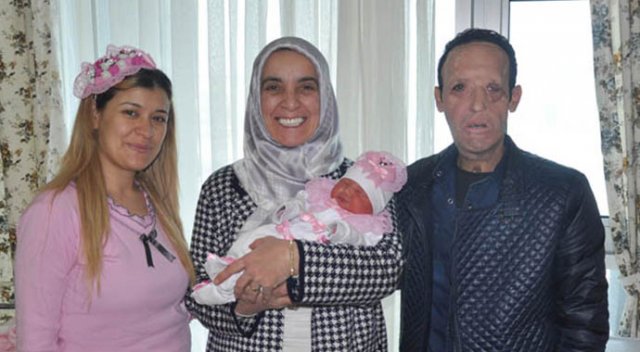 Yüz nakli olan Recep Sert'in babalık sevinci