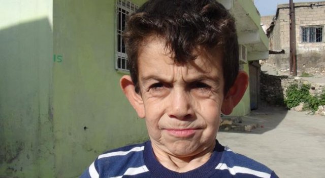 Küçük çocuğun yürek yakan dramı