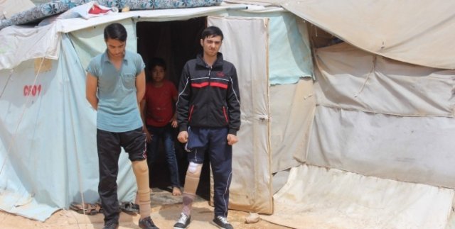 İkizlerin protez bacak sevinci