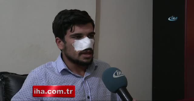 Kavga ettiği kuzeni tarafından burnu ısırılarak koparıldı