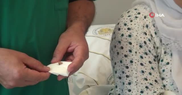 Çorba içerken akciğerine kaçan kemik 3 yıl sonra fark edildi