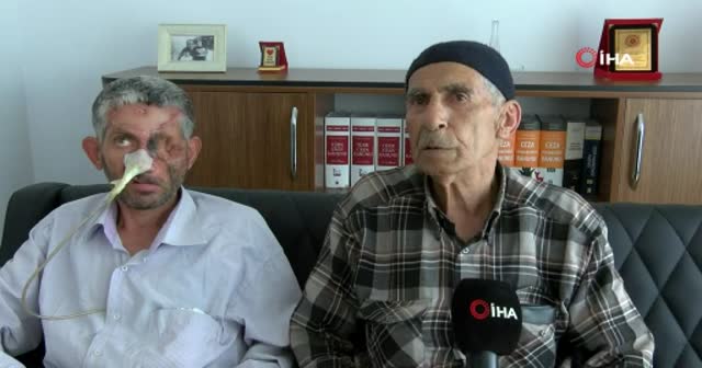 Hayret veren olay! Dişini çektirdi, gözünü kaybetti