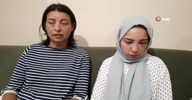 Köpek kavgası... 17 yaşındaki kızı acımasızca darp ettiler