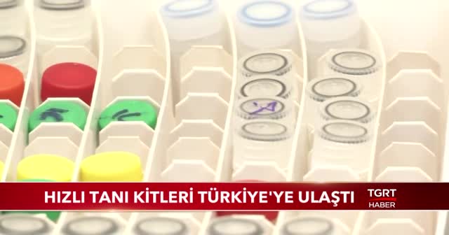 Hızlı tanı kitleri Türkiye'ye ulaştı