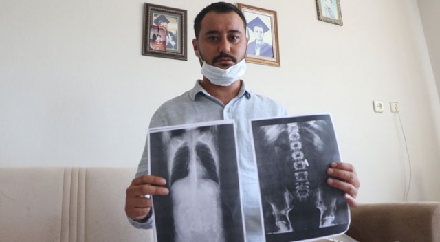 15 Temmuz gazisi, 4 yıldır vücudunda hainlerin sıktığı mermiyle yaşıyor