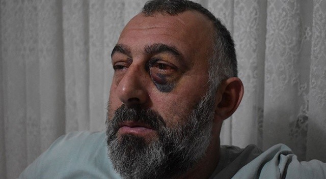 Söylenen yolcuya otobüs şoförlerinden dehşet: Feci şekilde darp edildi