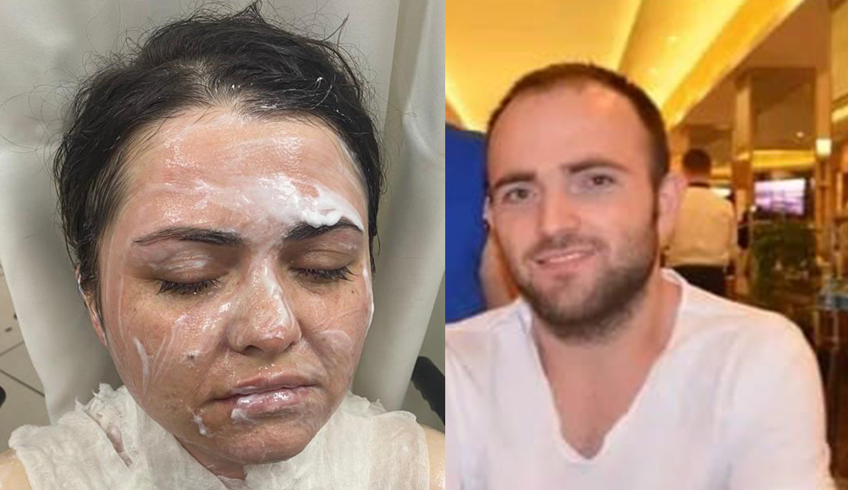 Eski eşe kimyasal saldırı: Sokak ortasında dehşeti yaşadı