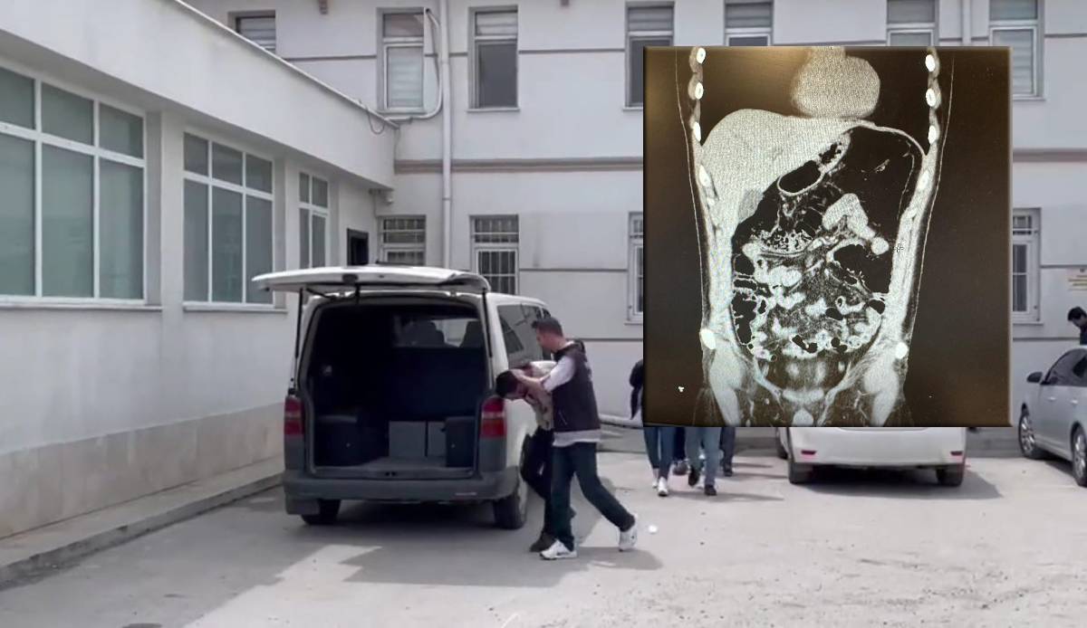 Midesinde eroinle yakalandı, savunması şoke etti!