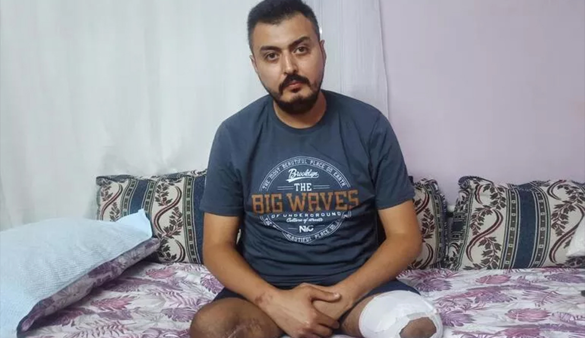 Eşi, iki çocuğu ve iki bacağını kaybetti! Depremin acı hikayesi