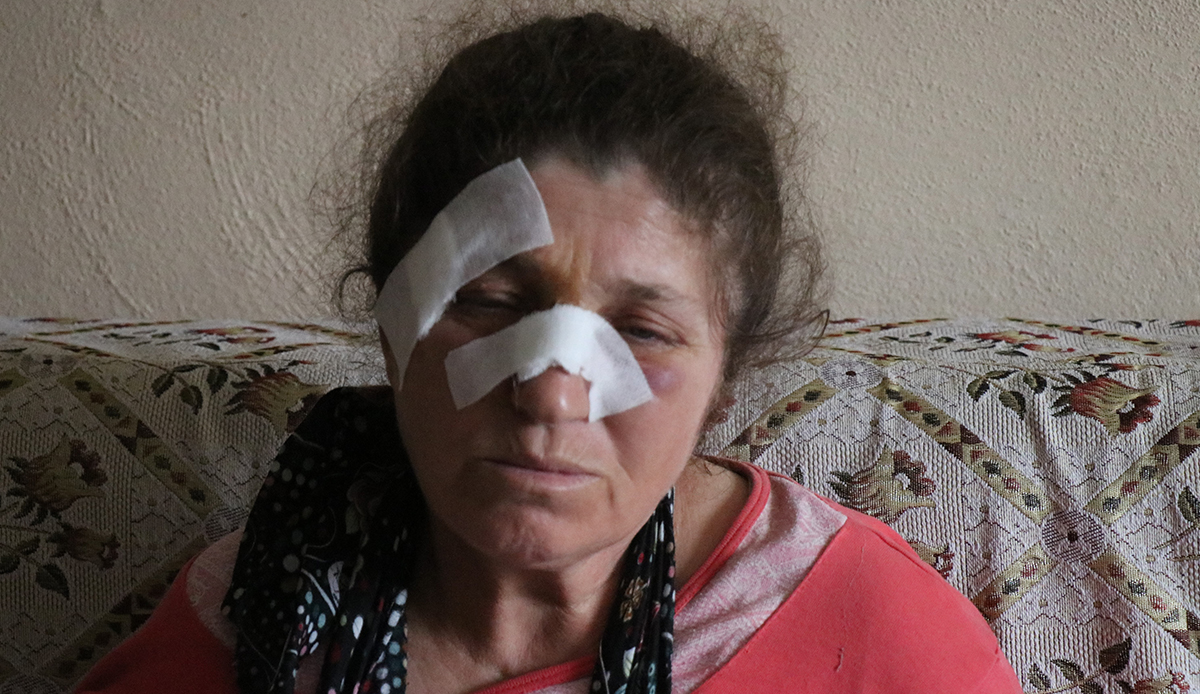 4 çocuk annesi acımasızca darp edildi! "Baltayla, yumrukla vurdu"