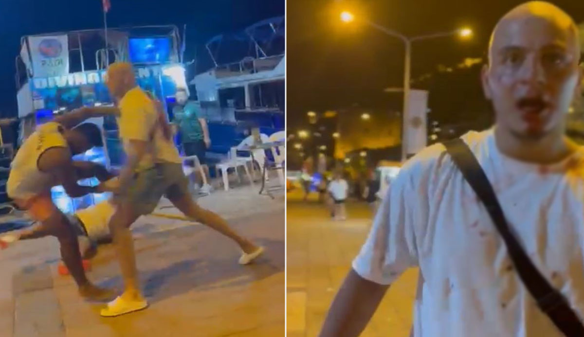 Almanya’dan gelen gurbetçi genç 6 kişinin sopalı saldırısına güçlükle direndi: O anlar kamerada!