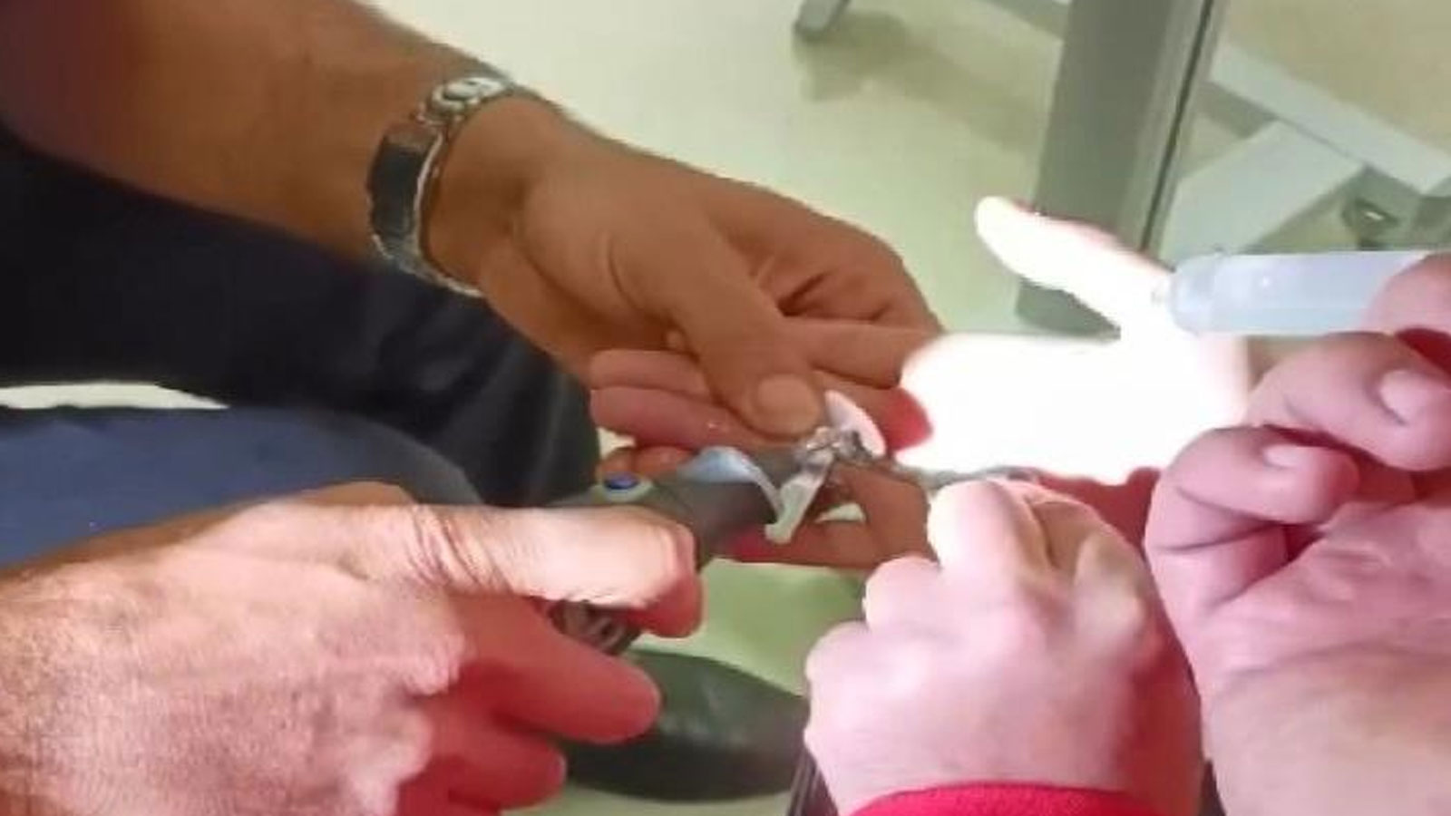 İtfaiye ekipleri harekete geçti! Parmağa sıkışan sıkışan yüzüğü kurtardılar