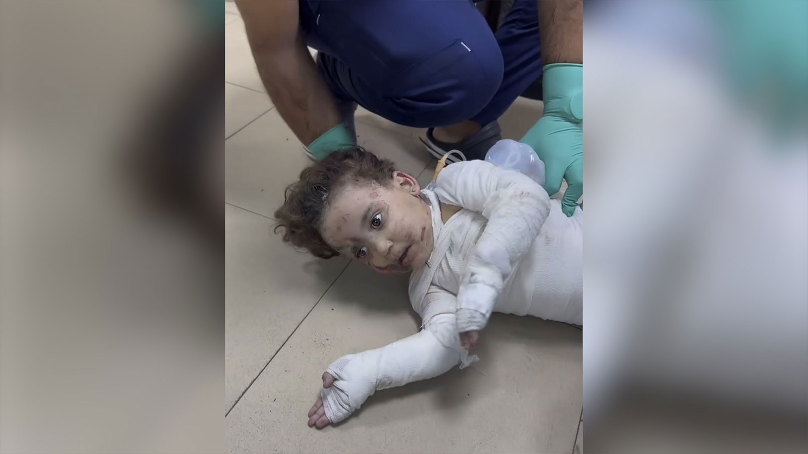 İsrail saldırılarında tüm vücudu yanan bebeğin 'anne' haykırışı yürek dağladı