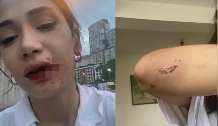Kız kardeşlere sokak ortasında saldırı! Önce darp sonra gasp ettiler - gundem
