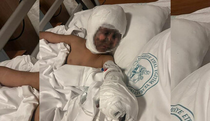 Esenyurt’ta korkunç olay! Ailenin çığlıkları ile mahalleli sokağa döküldü: Küçük çocuğun yüzünde elektrik trafosu patladı - gundem