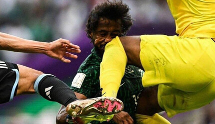 Yasser Al-Shahrani turnuvayı kapattı! Burnu, üç dişi, çenesi ve yüz kemiklerinde kırık - spor