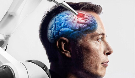 Hayvanlar deneylerde ölmüştü... Elon Musk, beyin implantlarının insan testlerine başlayacağını açıkladı! İlk cihazı kendi kafasına takacak - teknoloji