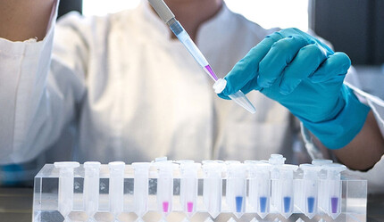 20-24 yaş grubu zirvede! HIV-AIDS artış şampiyonuyuz - saglik