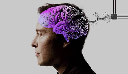 Beyin çipleri deneklerin ölümüne yol açmıştı… Elon Musk’ın Neuralink şirketine soruşturma! - teknoloji