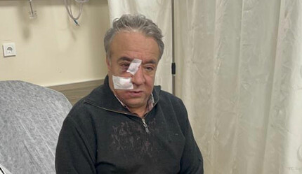 İstanbul'da sağlıkçıya şiddet! Aile hekimi kanlar içinde kaldı: Şu an ölmediğime şükrediyorum - gundem