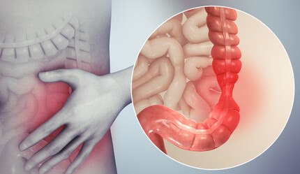 Uzmanı ‘sinsice ilerleyebilir’ diyerek uyardı… Şişkinlik ve kansızlıkla belirti veriyor! - saglik