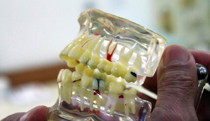Bir sahte doktor vakası daha: Protez diş vaadiyle onlarca kişiyi dolandırdı - dunya