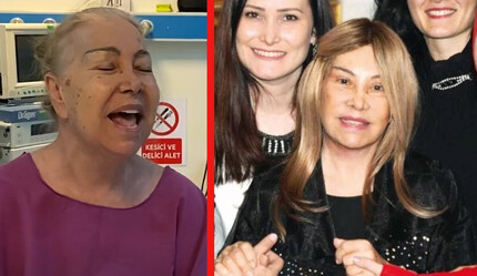 81 yaşındaki Bedia Akartürk genç görünmek için yüzünü gerdirdi, son haline yorum yağdı - magazin