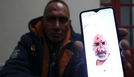 Afrika'nın en tehlikelisi Antalya'ya giden 48 yaşındaki adamı korkunç hale getirdi, hayatını kararttı: Yüzü tanınmayacak hale geldi - gundem